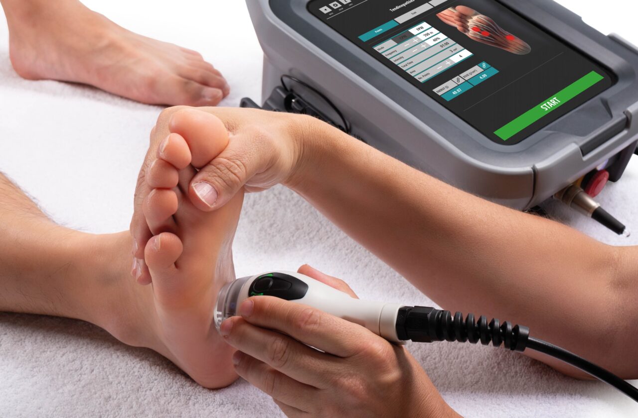 Chronic plantar fasciitis treated with LLLT MLS Laser