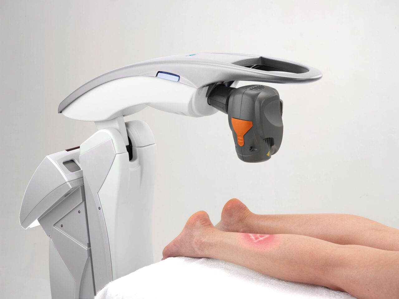 Patient being treated with robotic scanning laser.