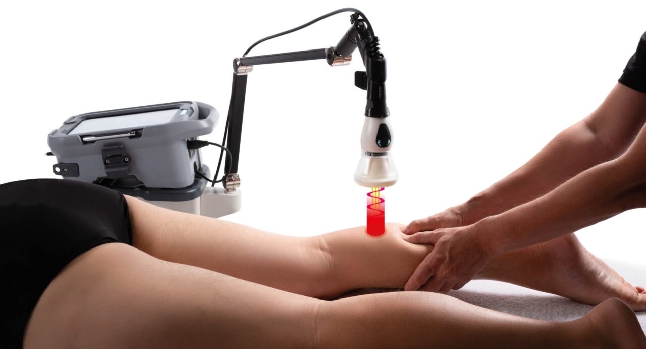MLS Laser being used to relieve plantar heel pain