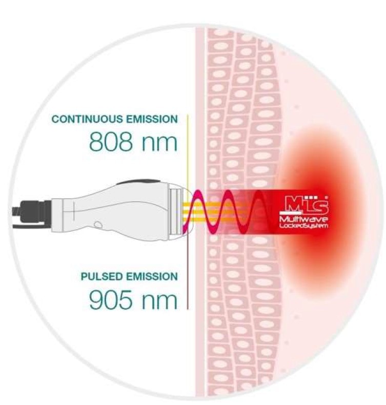 Graphic representation of dual synchronised wavelengths in MLS Therapy 