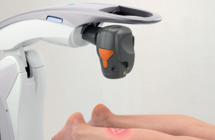 Robotic MLS laser in use