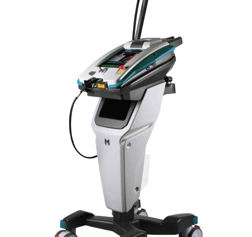 MiS laser