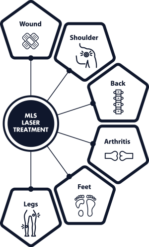 laser-treatment-infographic